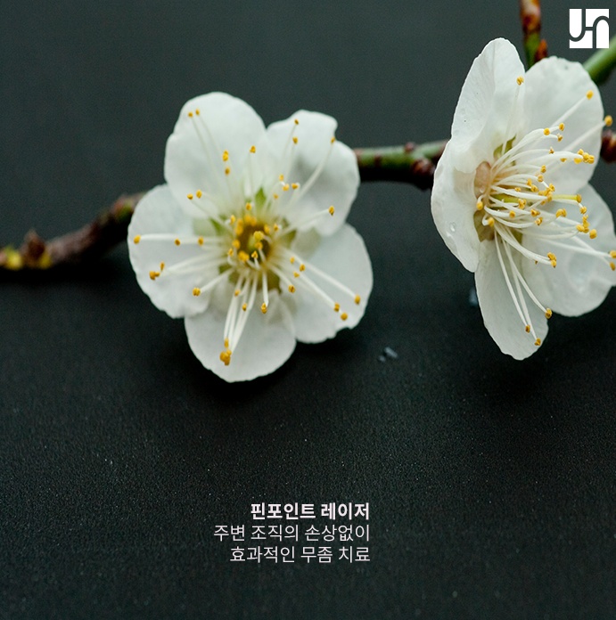 약물 치료로 역부족인 무좀, 핀 포인트 레이저로 치료하기 관련 이미지 3