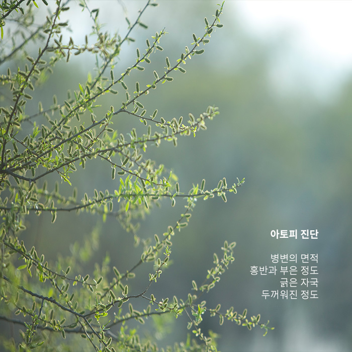 [방배역피부과] 중증도에 따른 아토피 치료법 관련 이미지 3