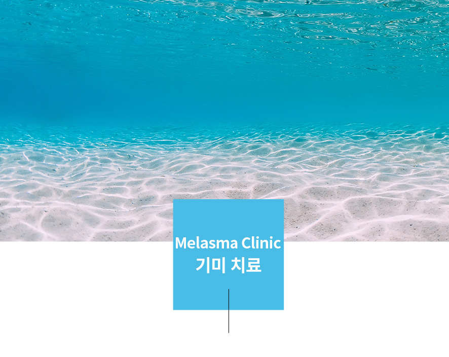 얼굴기미레이저 치료, 깊은 곳에 있는 색소까지 잡아야 진짜 치료 관련 이미지 1