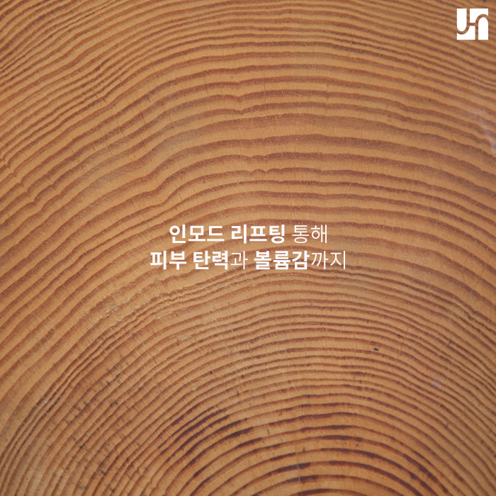 인모드 리프팅 통해 피부 탄력과 볼륨감까지 관련 이미지 1
