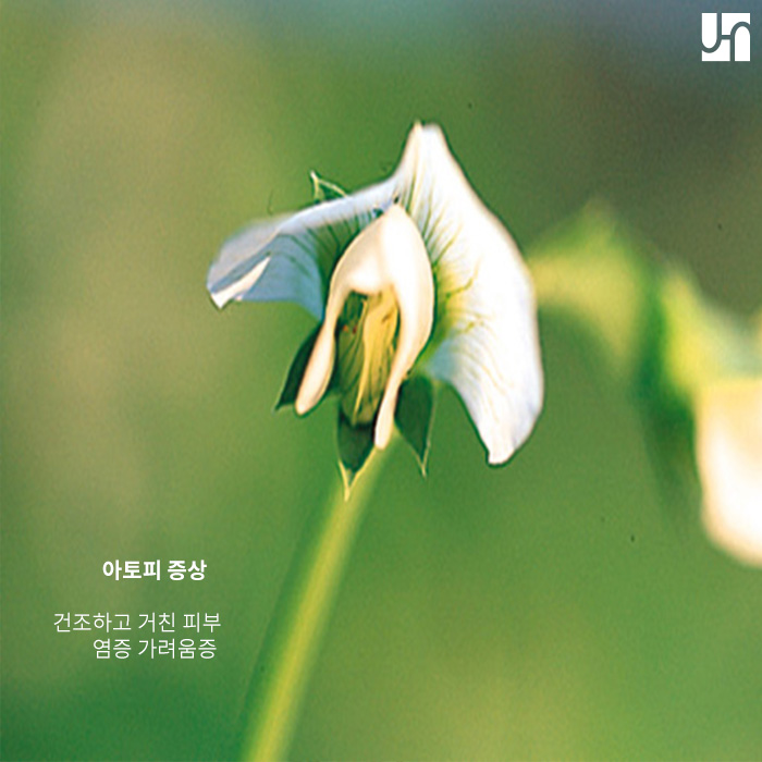 아토피 피부염 악화되기 전에 치료하기 관련 이미지 2