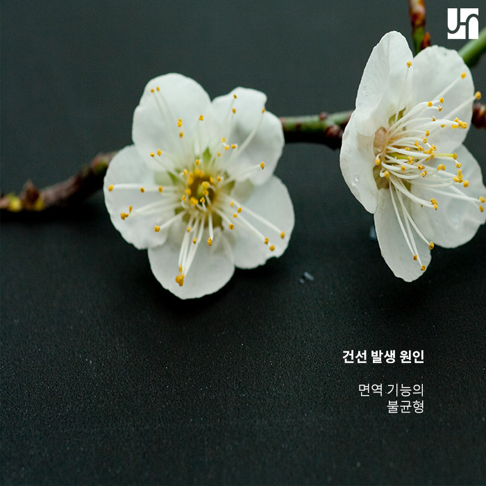 건선이 생기는 원인과 치료법 관련 이미지 2