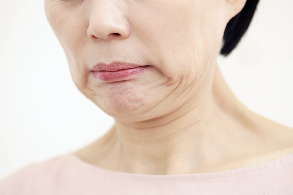 사당동 피부과 이중턱살 리프팅 늘어진 턱살 살리는 레이저 관련 이미지 1