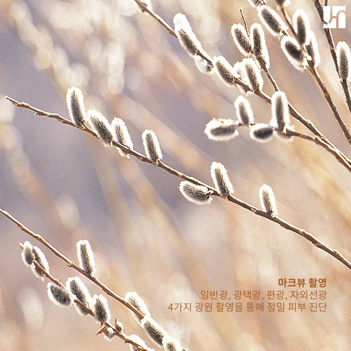 객관적이고 정확한 피부 진단을 위한 마크뷰 촬영 관련 이미지 3