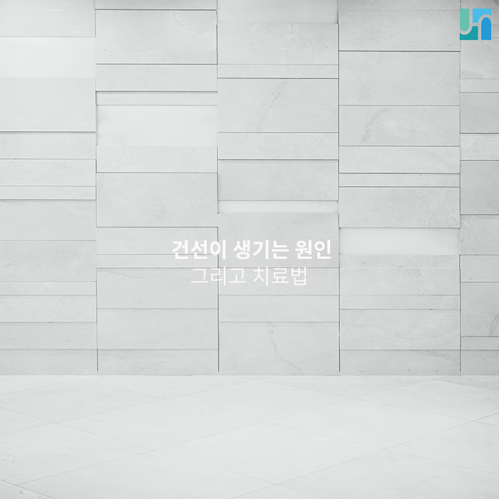 건선이 생기는 원인과 치료법 관련 이미지 1