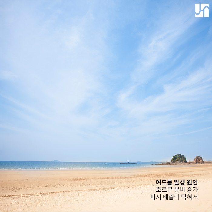 방배역 피부과, 여드름의 종류와 치료방법 관련 이미지 2