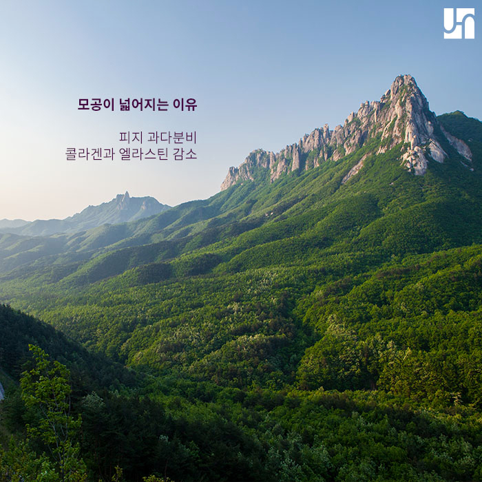 넓어진 모공관리를 위한 모공수축 천연팩 & 모공치료 :: 서초동전혜주피부과 관련 이미지 2