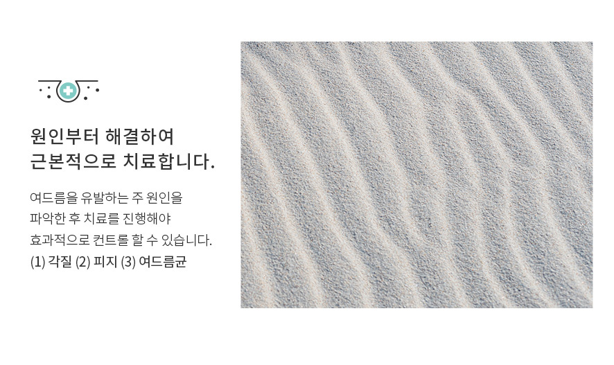 다양한 여드름 형태, 정확하게 파악하고 치료해야! 관련 이미지 2