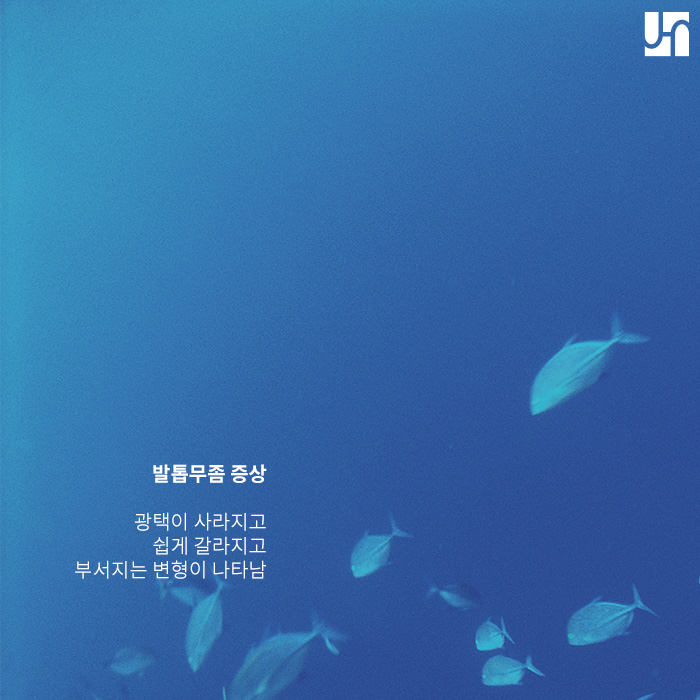 발톱무좀 레이저 치료로 개선이 가능한가요? 관련 이미지 3