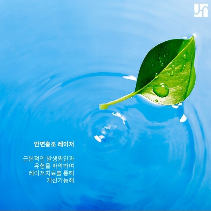 얼굴이 너무 붉어지는 안면홍조, 레이저 및 복합 치료가 필요해요 관련 이미지 4