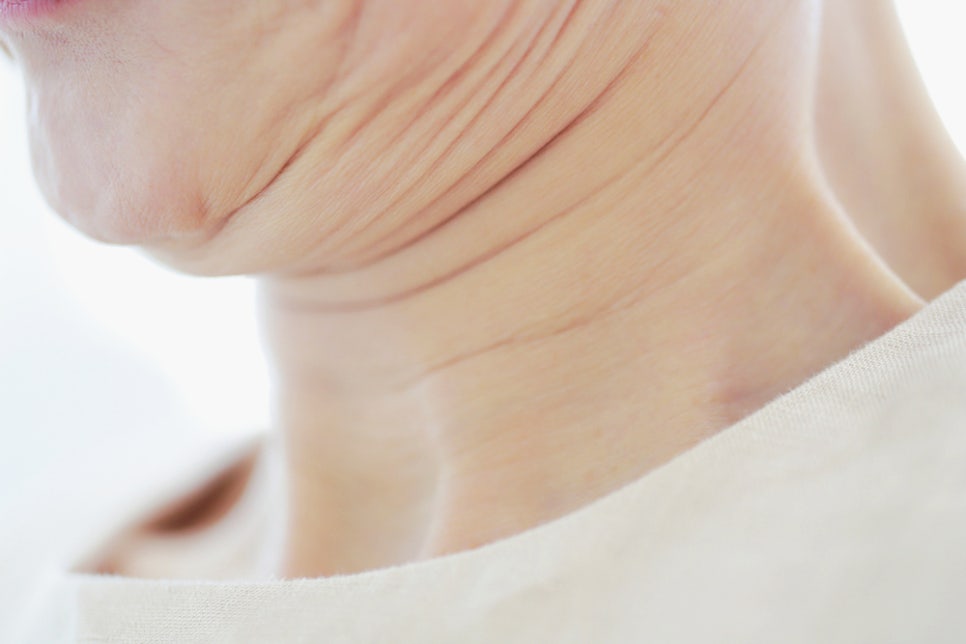 방배역 피부과 이중턱살 빼는법 다이어트를 해도 턱살만 안 빠진다면 이유가 있어요 관련 이미지 1