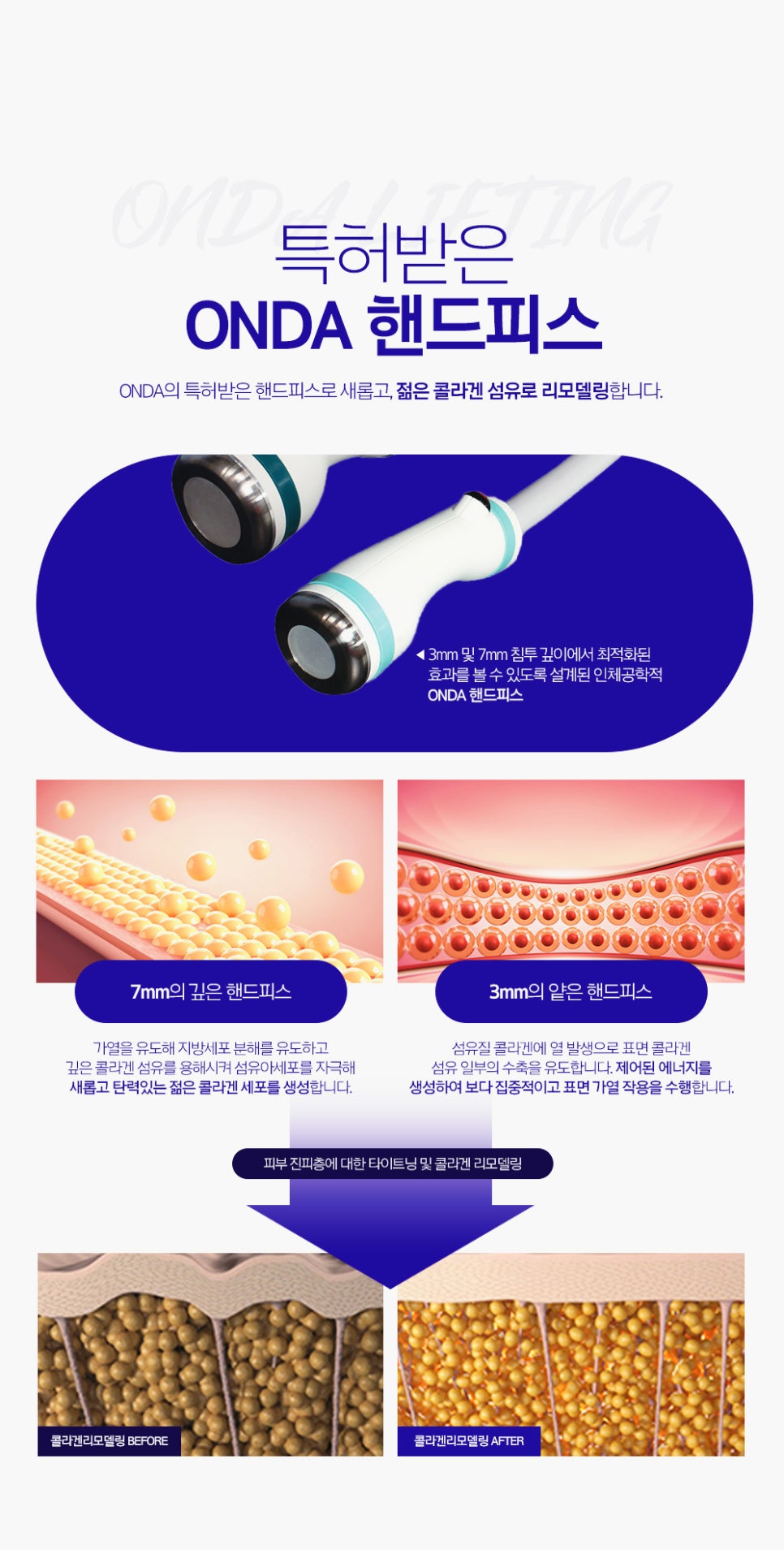 서초역 피부과 이중턱살 리프팅 효과와 얼굴 라인 정리하는 피부과 레이저 치료 관련 이미지 4