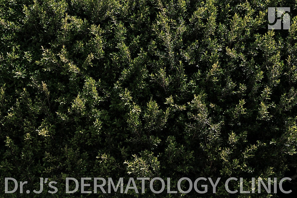 고데기 화상흉터 빠르게 치료하고 없애자 관련 이미지 3