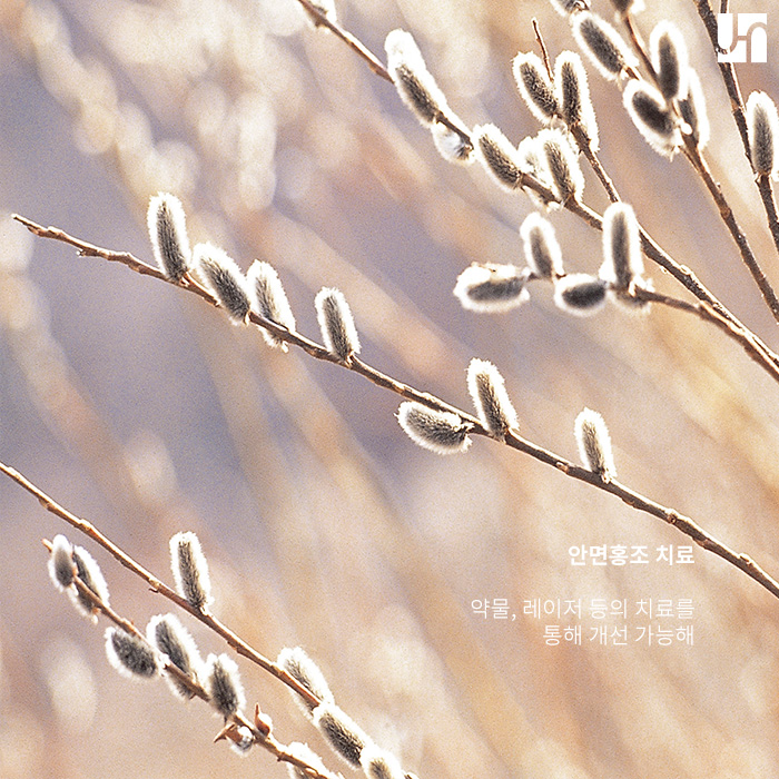 방배역 피부과, 얼굴이 붉은 이유는 안면홍조? 관련 이미지 4