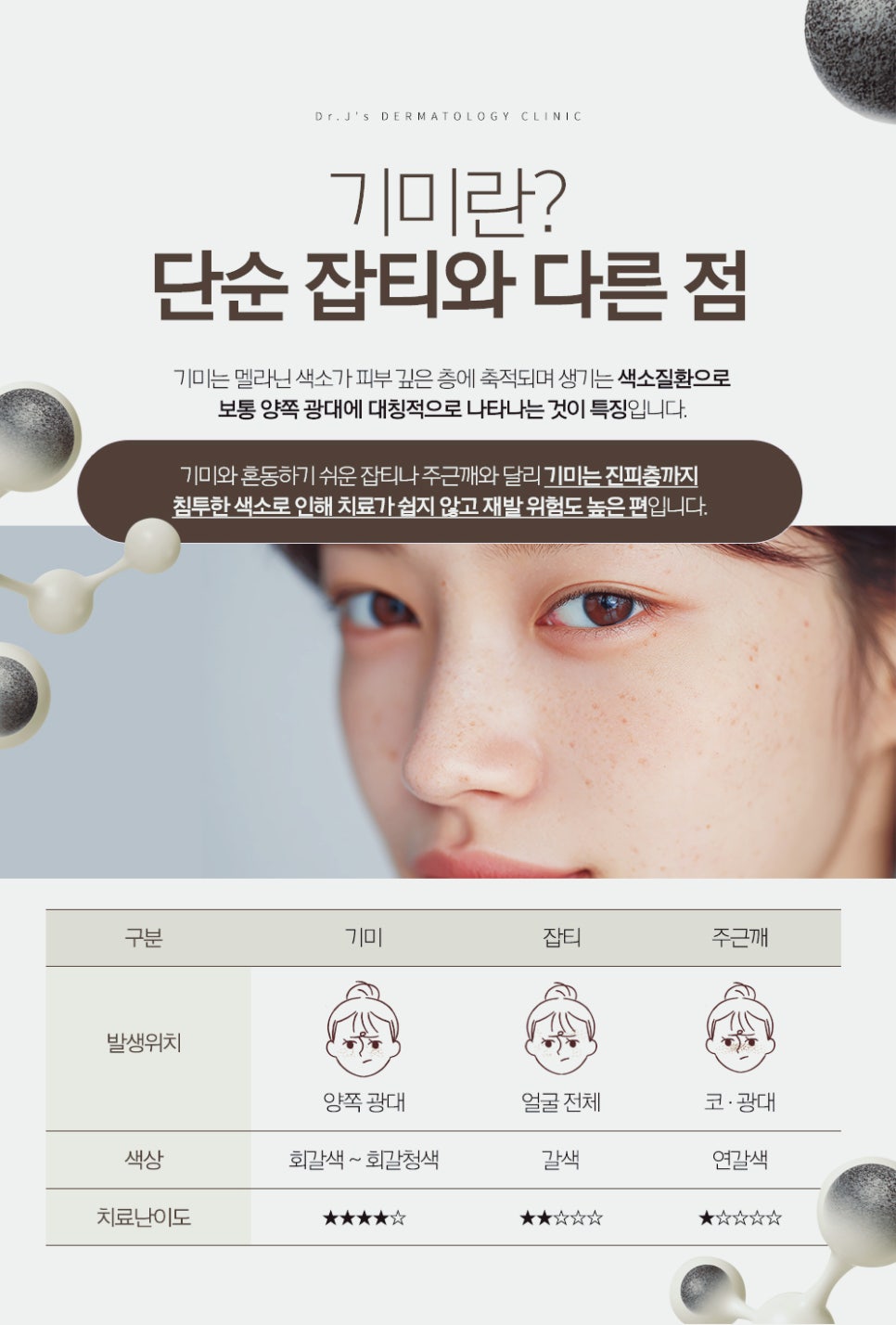 서초 피부과 다양한 색소질환 종류와 치료법에 대해 관련 이미지 3