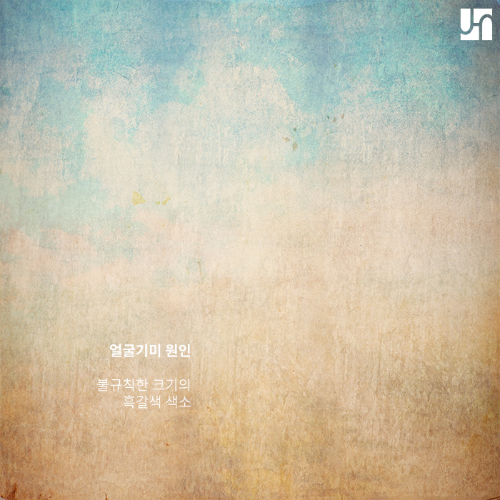 내방역피부과, 얼굴기미없애는방법 무엇이 있을까? 관련 이미지 3