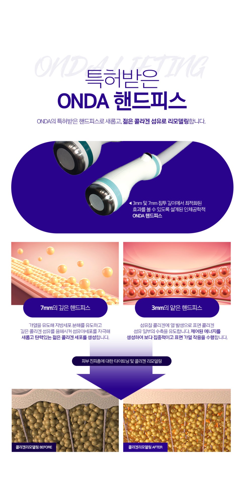 방배역 피부과 온다리프팅 만족스러운 후기, 효과, 피부 관리 굿 관련 이미지 4