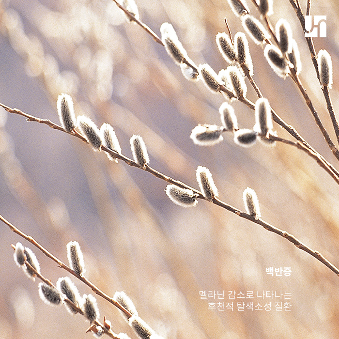 [서초역 피부과] 색소침착의 종류와 예방법 관련 이미지 2