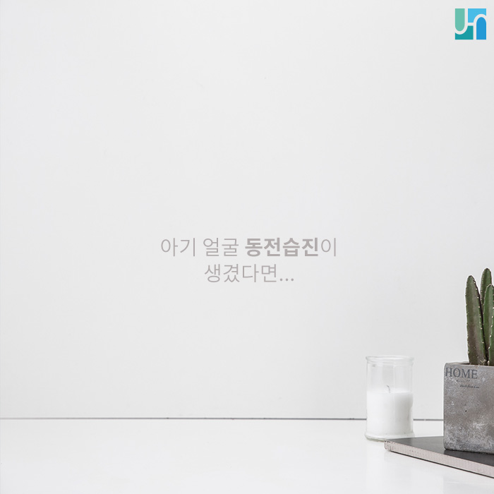 아기 얼굴 동전습진이 생겼다면... 관련 이미지 1