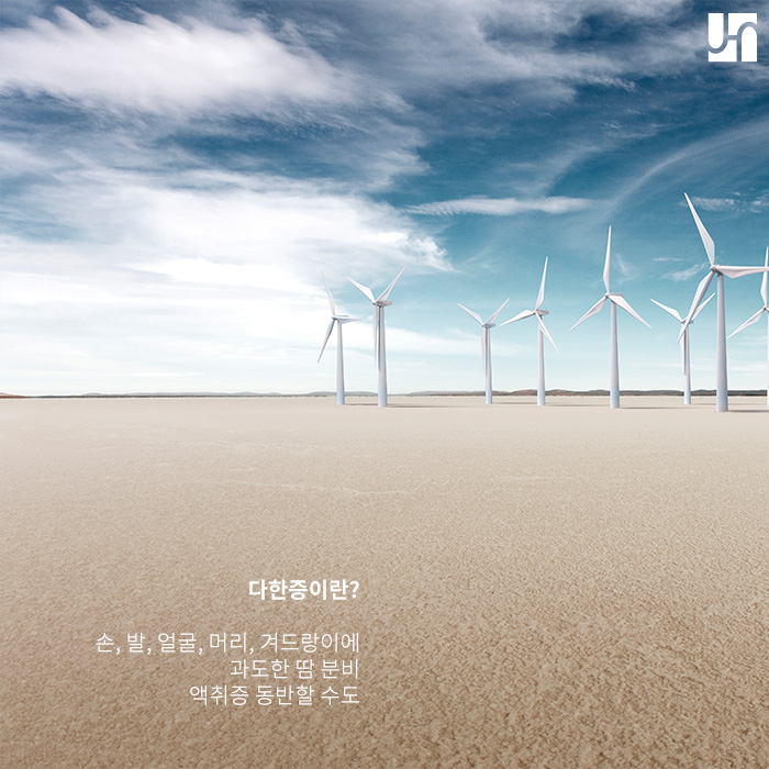 다한증 때문에 여름이 두렵다면 보톡스로 해결해봐요! 관련 이미지 3