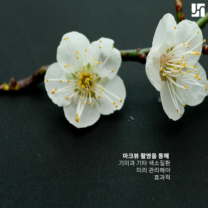 예방이 최선인 기미, 가장 효과적인 방법은? 관련 이미지 4