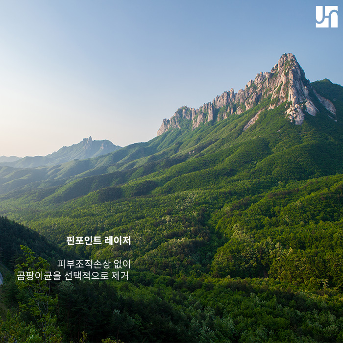 손발톱 무좀, 핀포인트레이저로 이젠 걱정 끝! 관련 이미지 4