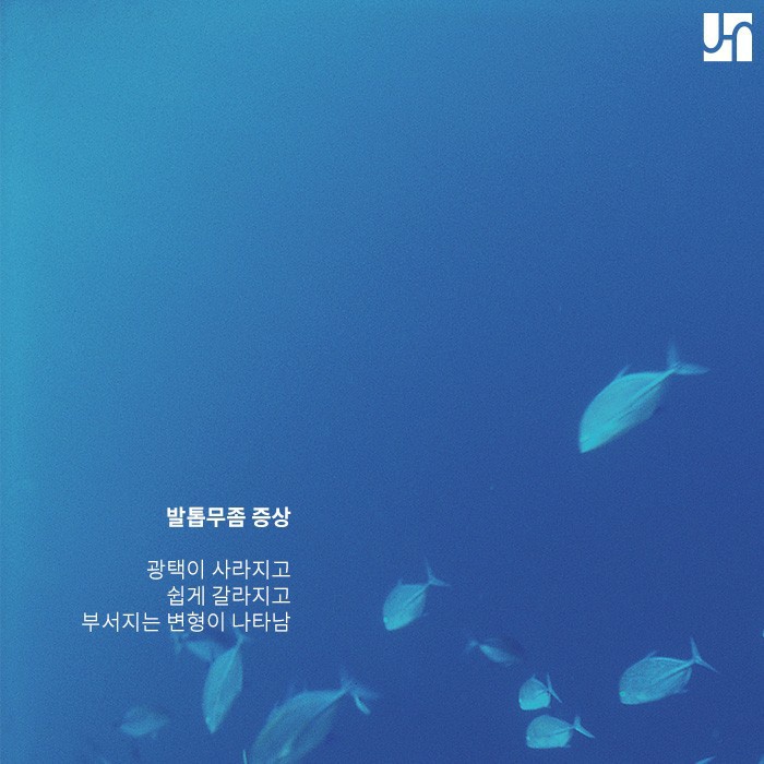 피부 사상균에 의한 손발톱 무좀, 핀포인트 레이저로 개선할 수 있어! 관련 이미지 2