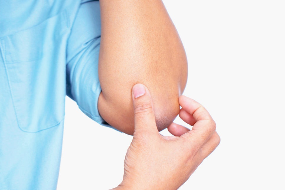 Sadang-dong Dermatology Clinic: Psoriasis Treatment—There Is a Reason Why Skin That Gets Worse the More You Scratch Keeps Recurring image 3