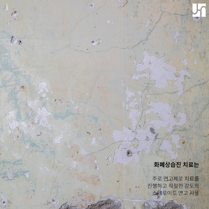 환절기에 주의하세요! 관련 이미지 4