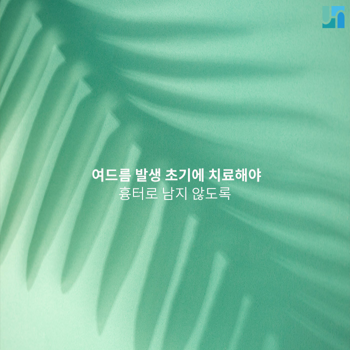 여드름 발생 초기에 현명하게 치료해야 후회하지 않아 관련 이미지 1