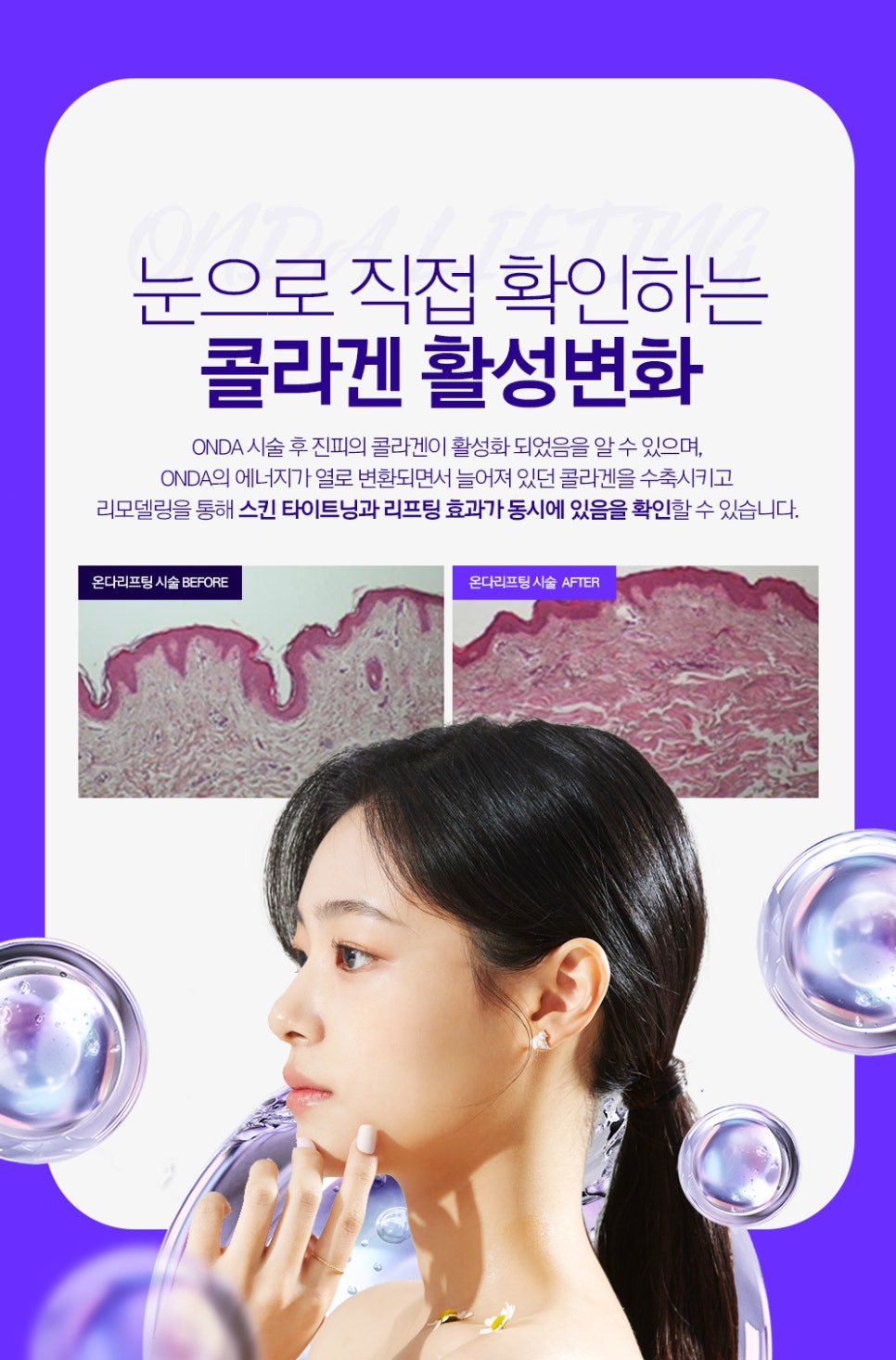 방배역 피부과 온다리프팅 만족스러운 후기, 효과, 피부 관리 굿 관련 이미지 5