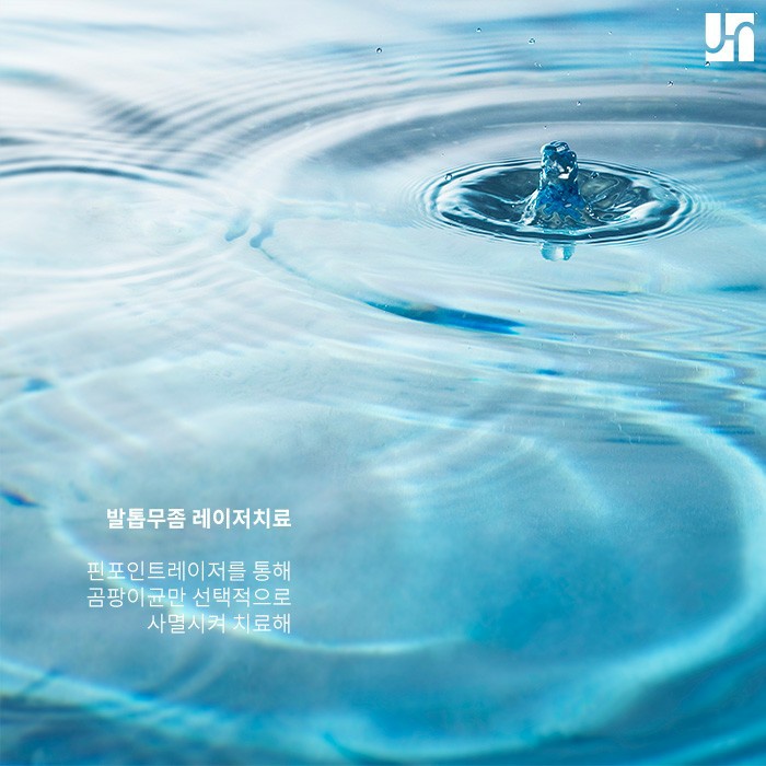 피부 사상균에 의한 손발톱 무좀, 핀포인트 레이저로 개선할 수 있어! 관련 이미지 3