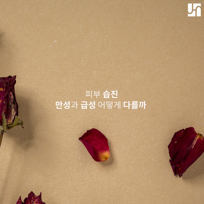 피부습진, 만성과 급성 어떻게 다를까 관련 이미지 1