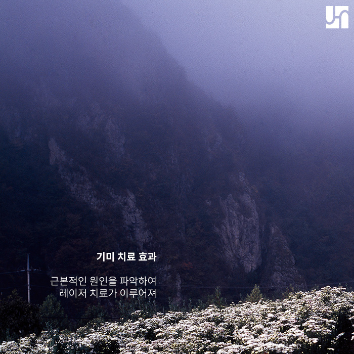 기미 주근깨 레이저를 통해 개선하자 관련 이미지 4