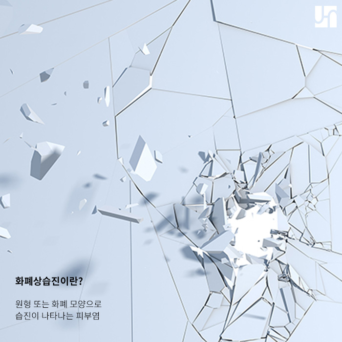 환절기에 주의하세요! 관련 이미지 2