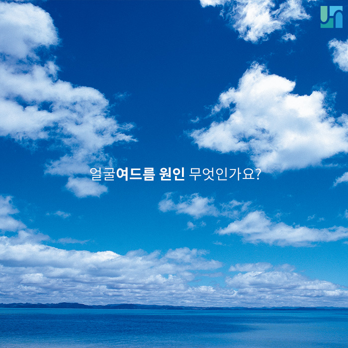 서초역 피부과, 얼굴여드름 원인 무엇인가요? 관련 이미지 1