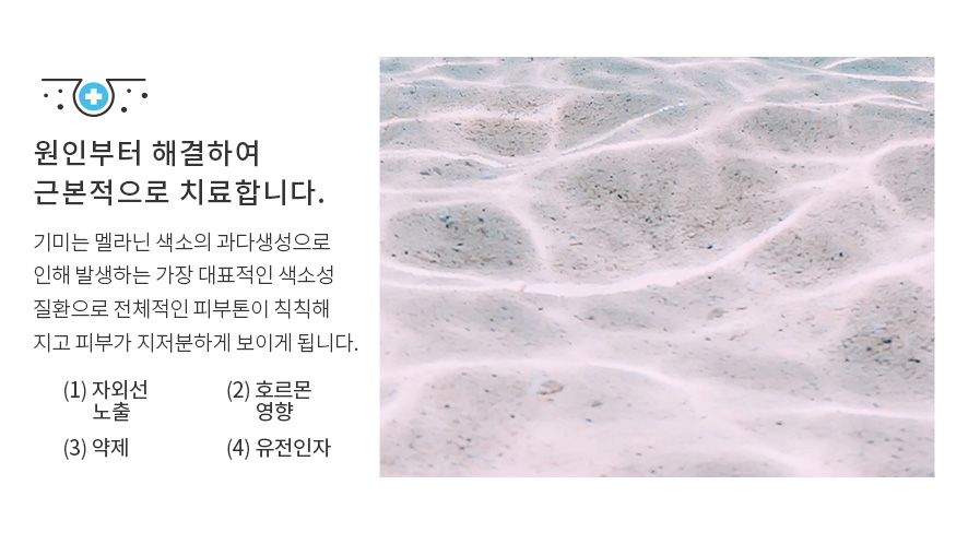얼굴기미레이저 치료, 깊은 곳에 있는 색소까지 잡아야 진짜 치료 관련 이미지 2