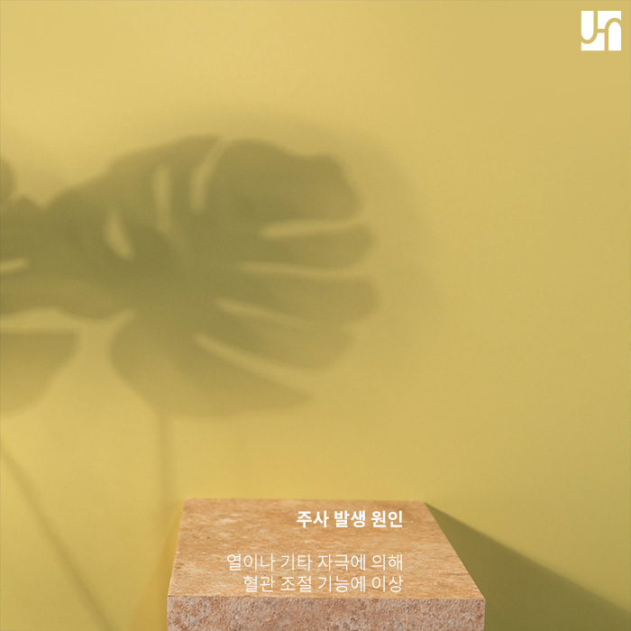 여드름과 유사한 주사 발생 원인과 해결 방법에 대해서 관련 이미지 2