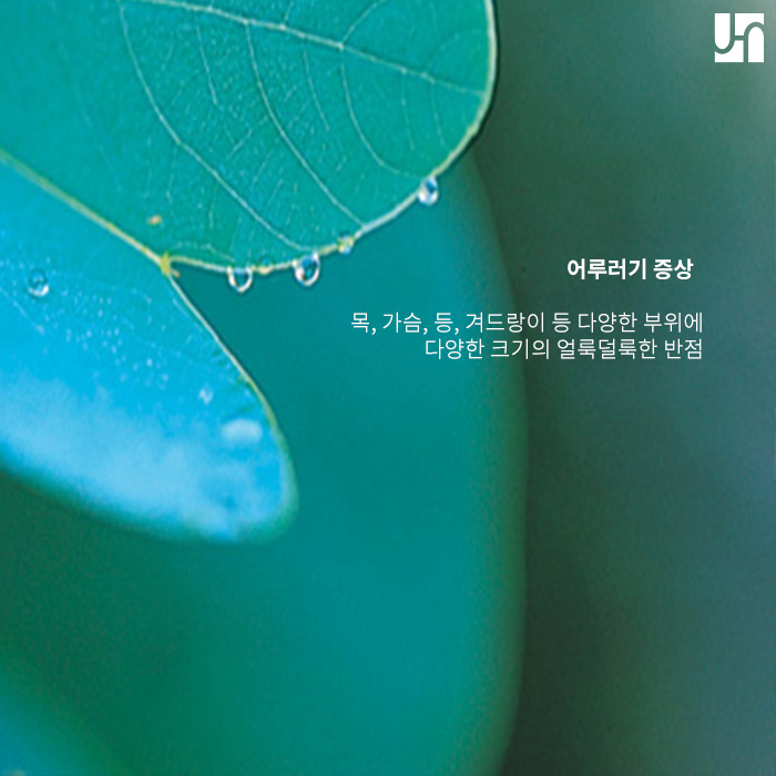 피부병 어루러기 발생 원인과 증상, 치료법에 대해서 관련 이미지 3