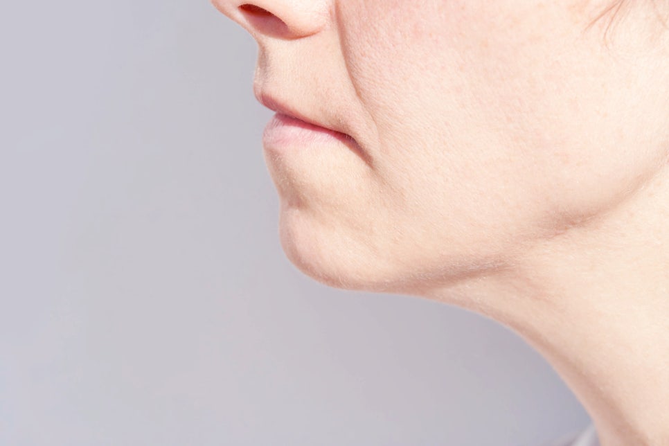 내방역 피부과 피부 처짐 고민 해결, 인모드와 클라리티 프로 리프팅 효과 관련 이미지 1