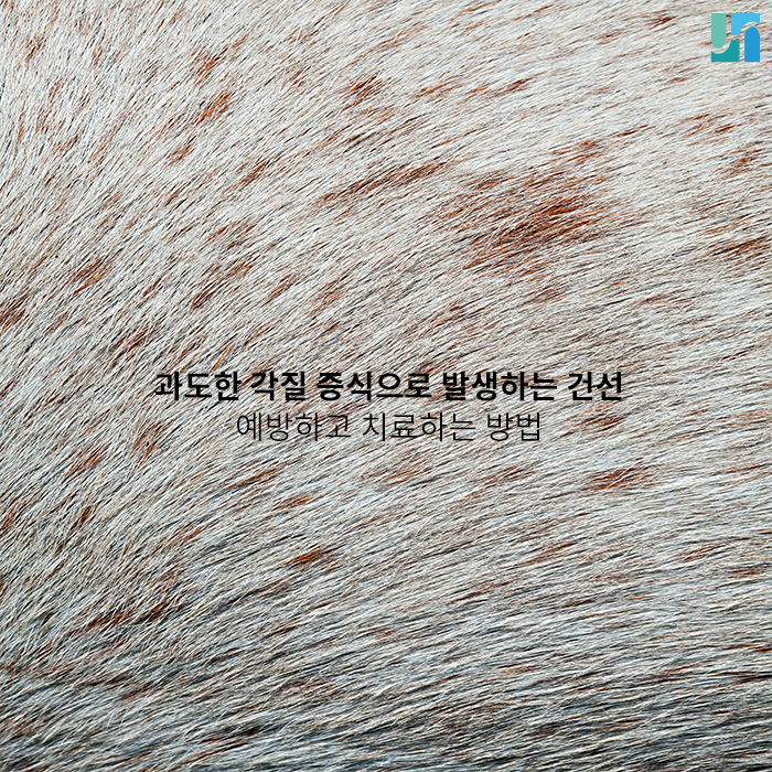 과도한 각질 증식으로 발생하는 건선, 예방하고 치료하는 방법은? 관련 이미지 1