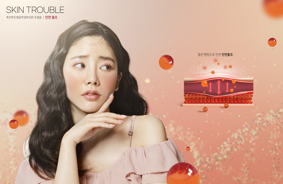 방배동 피부과 안면홍조, 화장으로 가리기보단 혈관을 치료해야 관련 이미지 3