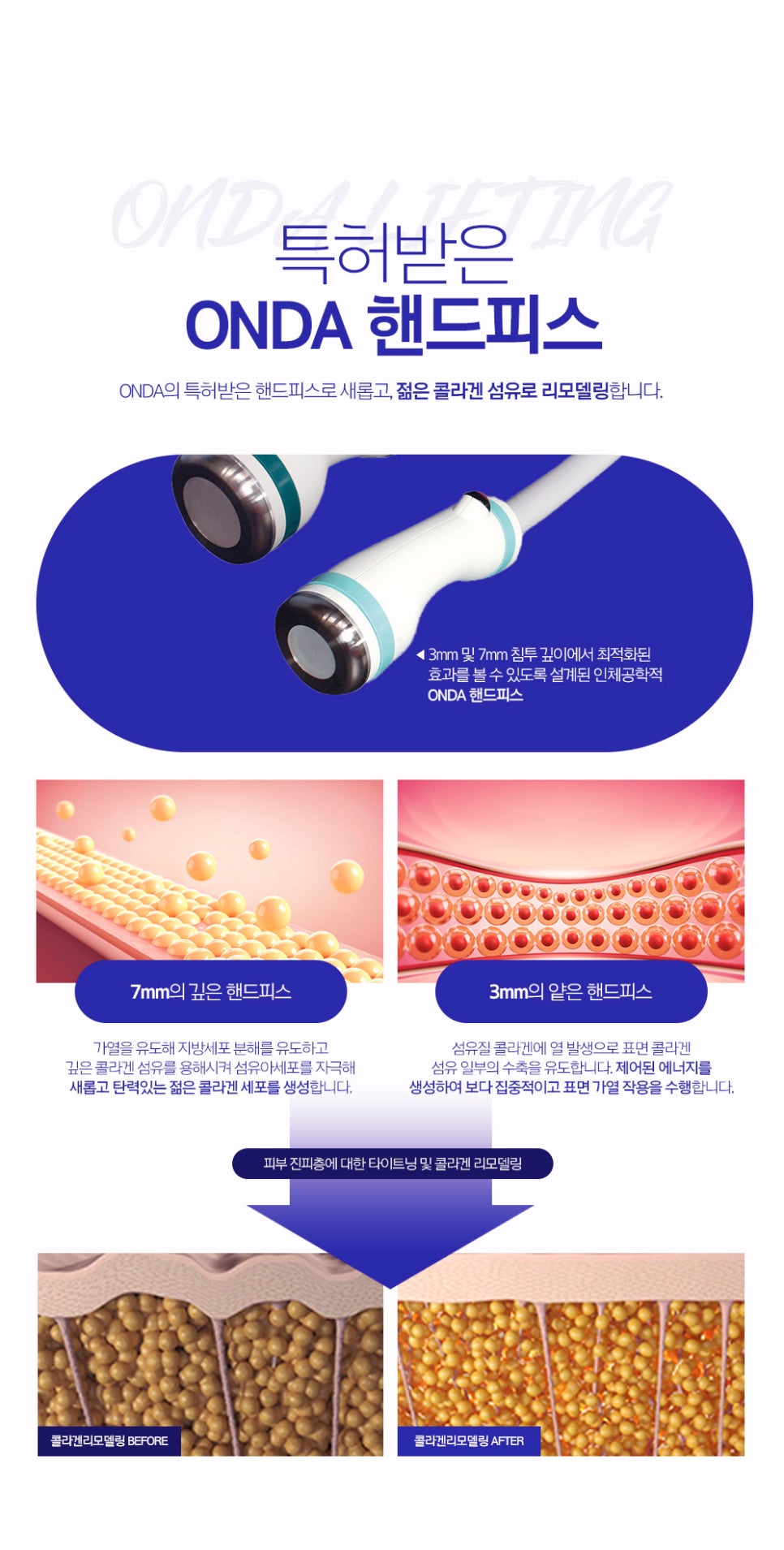 사당역 피부과 턱살 빼는 법, 온다리프팅이 탄력과 지방을 동시에 잡는 이유 관련 이미지 4