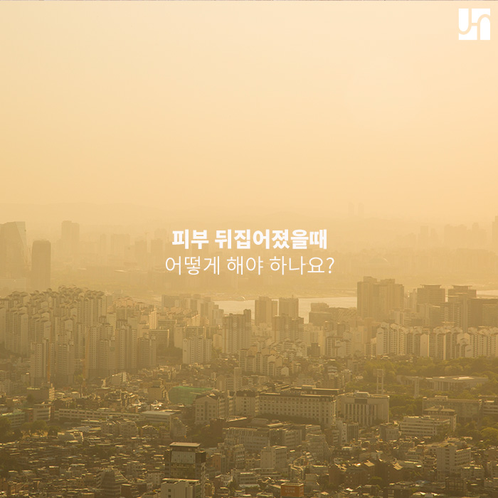 피부 뒤집어졌을때 어떻게 해야 하나요? 관련 이미지 1