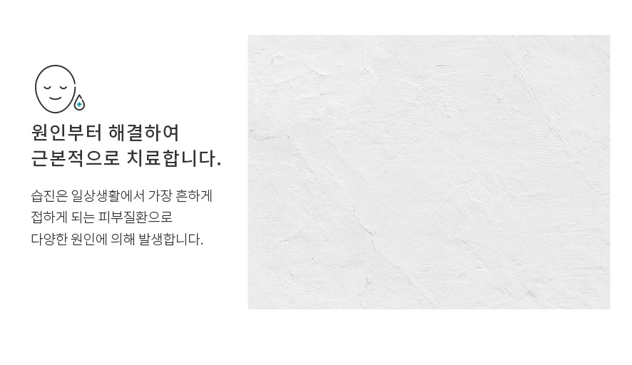 화폐상습진 연고로 개선 가능할까? 관련 이미지 3