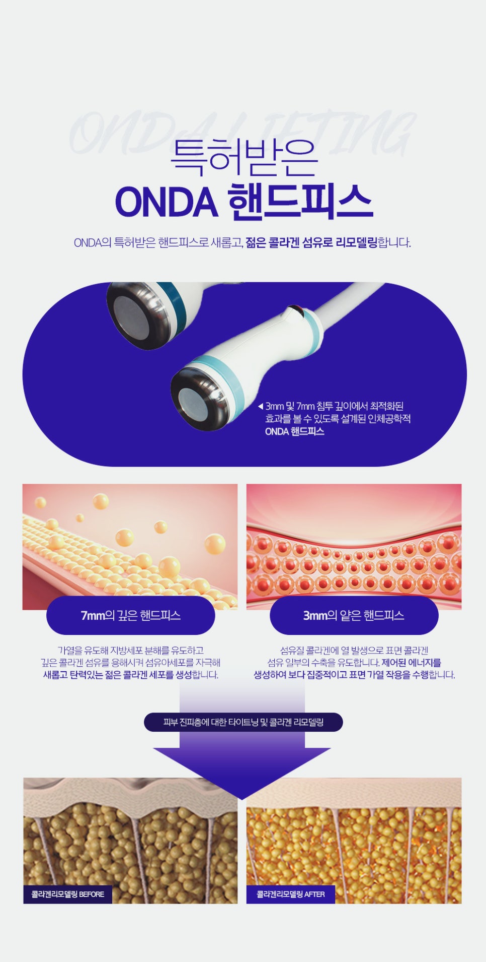방배역 피부과 얼굴 윤곽 리프팅 처진 볼살과 턱선 관리 방법 관련 이미지 3