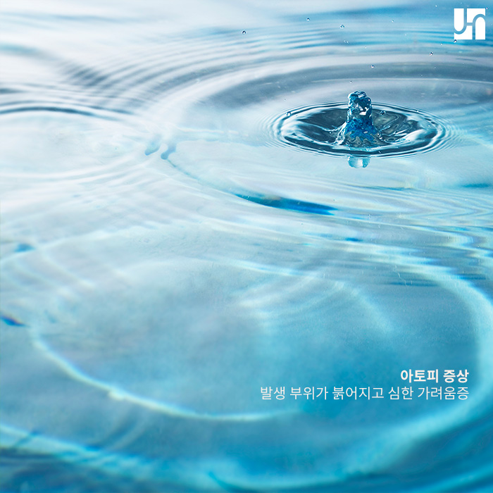 아토피 피부염 발생 원인과 대처법은? 관련 이미지 2