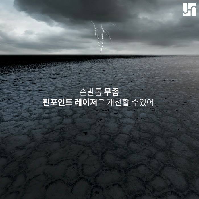 피부 사상균에 의한 손발톱 무좀, 핀포인트 레이저로 개선할 수 있어! 관련 이미지 1