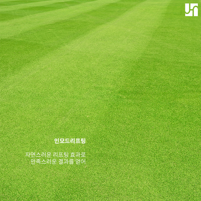 인모드 리프팅 효과 좋은가요? 관련 이미지 4