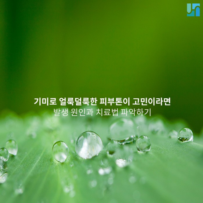 자외선이 강렬한 여름, 기미 발생에 특히 주의해야! 관련 이미지 1